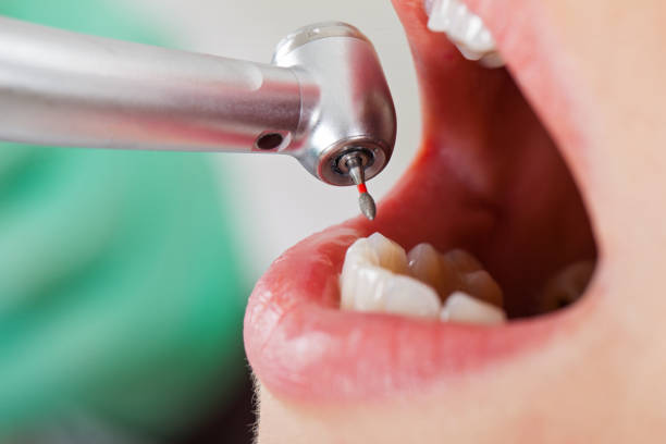 Best Dental Abscess Treatment in Elizabeth City, NC